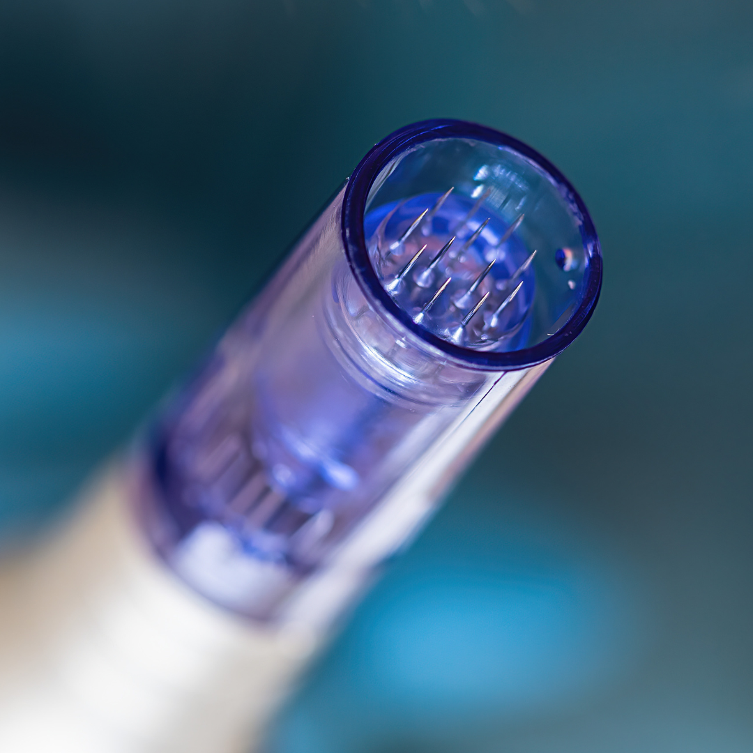microneedling