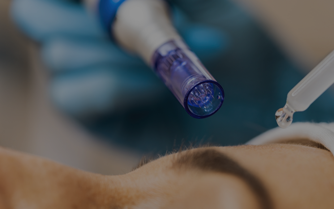 The Power Of Microneedling