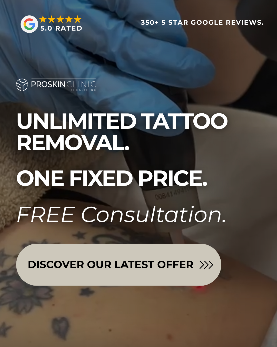 TATTOO REMOVAL TATTOO REMOVAL